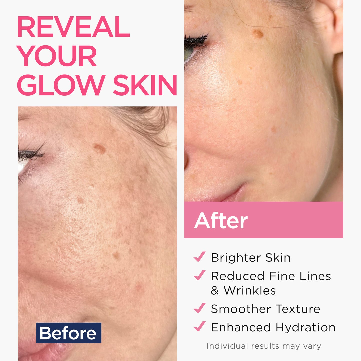 Age-Defying Retinol Serum Hyaluronic acid |Ember Cloud